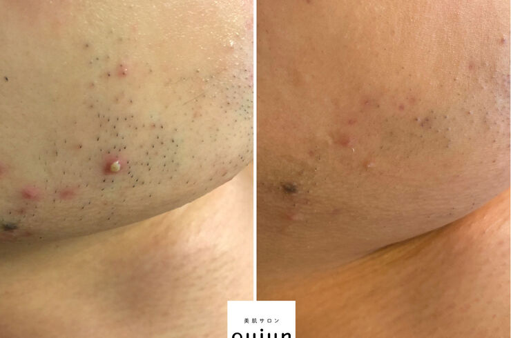 E0BEE8C4-9DB2-47C6-AEA5-88913050BF85