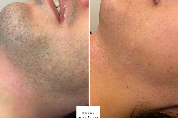 35132019-0B35-400B-951A-FF9228A4E68F