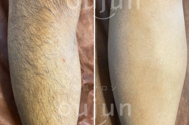 1A19C533-B5B8-4ACA-81BA-C465E84CE332