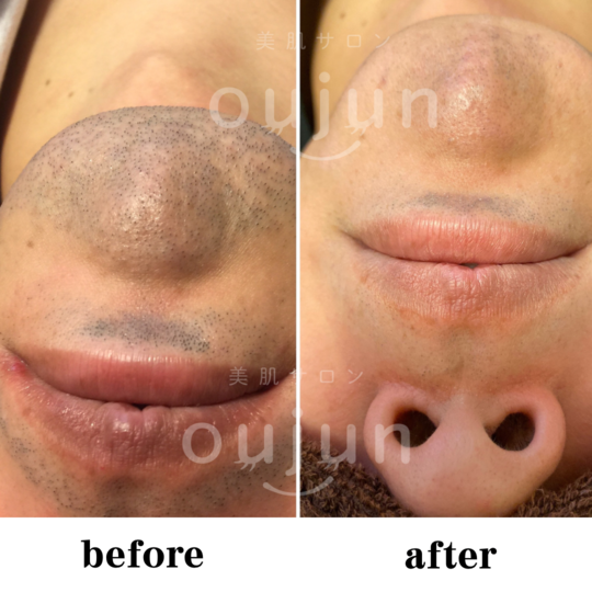 11AB5EB9-4D58-4170-9A65-66E8D2DB8191