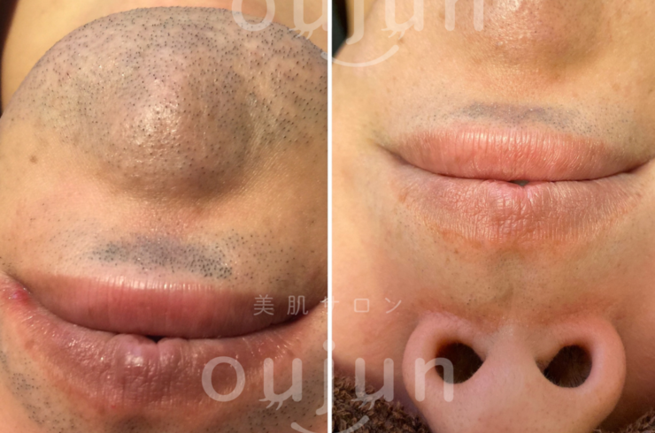 11AB5EB9-4D58-4170-9A65-66E8D2DB8191