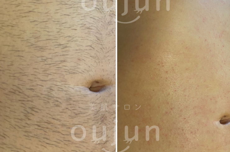 85582060-927E-40C6-BB4C-2722191A3E04