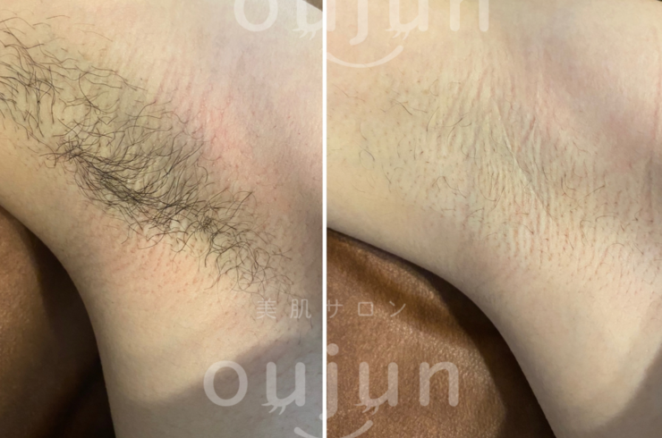 4B622F9F-A0B2-46C0-A677-406A20C58E87