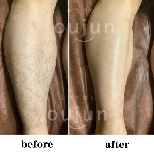 C380624A-5EFA-40BF-8459-13CEA8C28193