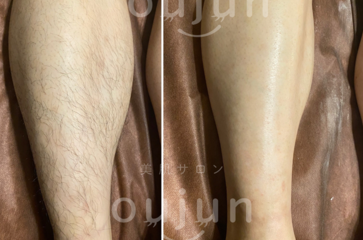 C380624A-5EFA-40BF-8459-13CEA8C28193